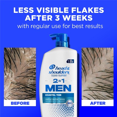 Head &amp; Shoulders Men&