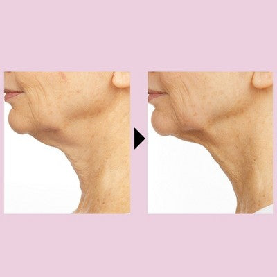No7 Restore &amp; Renew Multi Action Face &amp; Neck Serum 1.69 fl oz - Imperfect Box