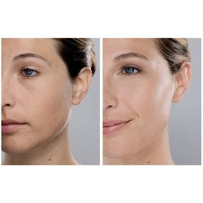 Spa Sciences SIMA Dermaplaning Replacement Safety Tips 6ct - New by This is Beauty US