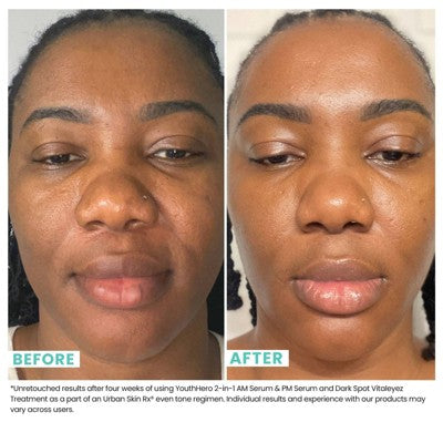 Urban Skin Rx Youth Hero 2-in-1 AM Serum &amp; PM Serum - Imperfect Box