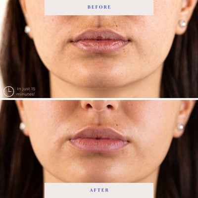 BioRepublic SkinCare Lip Masks 6pk - New