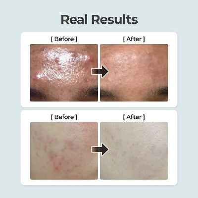 numbuzin No.1 Pure-Full Calming Herb Toner 10.14 fl oz - New