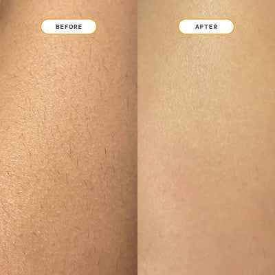 Nood Ingrown Hair Treatment The Eraser - Imperfect Box