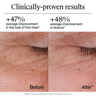 Neutrogena Rapid Wrinkle Repair Retinol Face Moisturizer Cream with Hyaluronic Acid 1.7oz - Imperfect Box by This is Beauty US