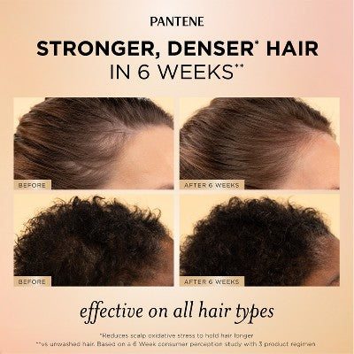 Pantene Abundant &amp; Strong Treatment Serum 2 fl oz - Imperfect Box