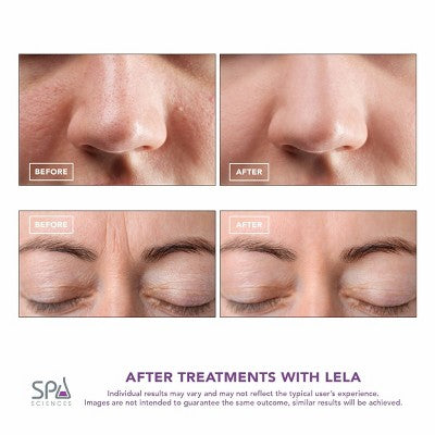 Spa Sciences LELA Ultrasonic Skin Scrubber Spatula Pink - Imperfect Box by This is Beauty US