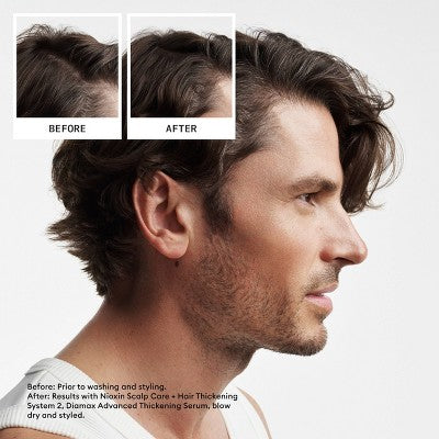 Nioxin System 2 Hair Thickening Natural &amp; Untreated Hair Shampoo &amp; Conditioner Kit 3ct - New
