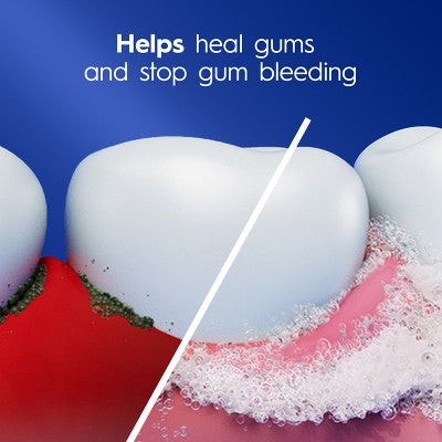 Crest Pro-Health Gum Detoxify Deep Clean Toothpaste 4.8oz - Imperfect Box by This is Beauty US