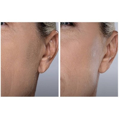 Spa Sciences SIMA Dermaplaning Replacement Safety Tips 6ct - New by This is Beauty US