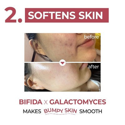 numbuzin No.3 Skin Softening Serum 1.69 fl oz - Imperfect Box by This is Beauty US
