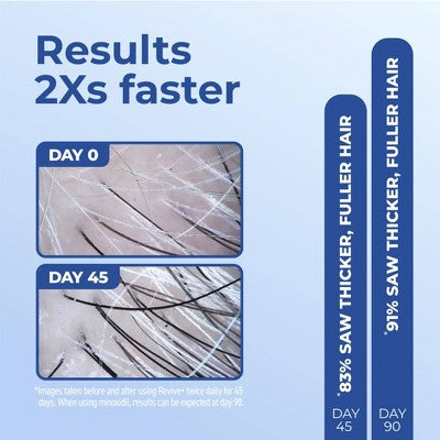BosleyMD Revive + Densifying Hair Regrowth Serum for Men 1 fl oz - Imperfect Box by This is Beauty US