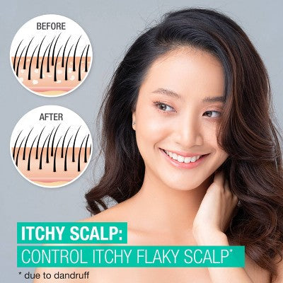 Neutrogena Scalp Therapy Itchy Scalp Shampoo 12 fl oz - Imperfect Container by This is Beauty US