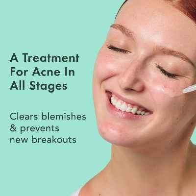 Rael Miracle Clear Complete Acne Treatment Face Serum 1oz - New