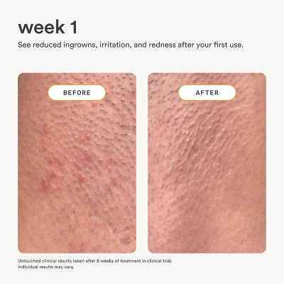 Nood After Care Serum 3.3 fl oz - New