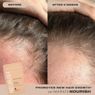Imarais Beauty Nourish Haircare Gummies Vegan and Sugar-Free 30ct - Imperfect Container by This is Beauty US