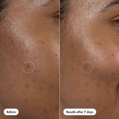 Hero Cosmetics Dark Spot Correct 10ml - New