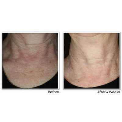 RoC Face &amp; Neck Anti-Aging Moisturizer Firming Cream for Crepey Skin 1.7 fl oz - New