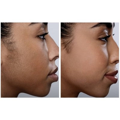 Spa Sciences SIMA Dermaplaning Replacement Safety Tips 6ct - New by This is Beauty US