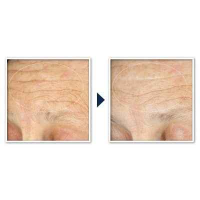 RoC Face &amp; Neck Anti-Aging Moisturizer Firming Cream for Crepey Skin 1.7 fl oz - New