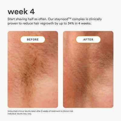 Nood After Care Serum 3.3 fl oz - New