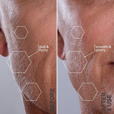 Spa Sciences SIMA Deluxe Sonic Dermaplaning Tool for Exfoliation &amp; Peach Fuzz Removal - Imperfect Box by This is Beauty US