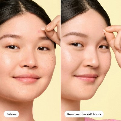 Hero Mighty Patch Invisible Mini 30ct - New by This is Beauty US