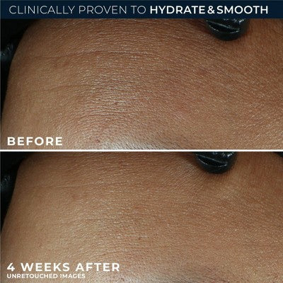 RoC Retinol Correxion Line Smoothing Max Hydration Cream 1.7oz - Missing Box by This is Beauty US
