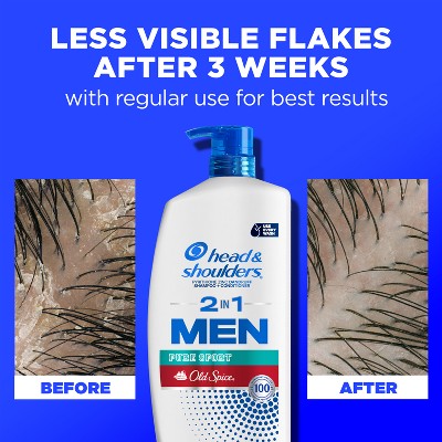 Head &amp; Shoulders Men&