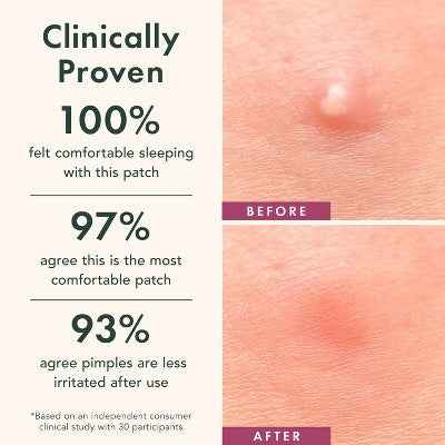 Rael Beauty Miracle Patch Glow and Go Kit 38ct - New