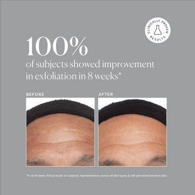 Naturium Azelaic Topical Acid 10% 1 fl oz - Imperfect Box  DestGlow