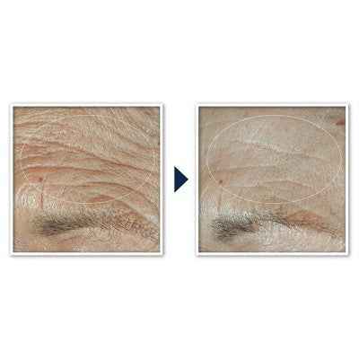 RoC Face &amp; Neck Anti-Aging Moisturizer Firming Cream for Crepey Skin 1.7 fl oz - New