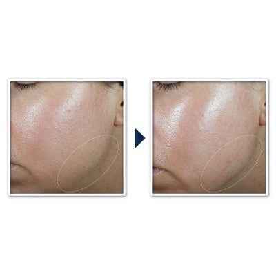 RoC Derm Correxion Contour Cream for Face and Neck 1.7oz - New