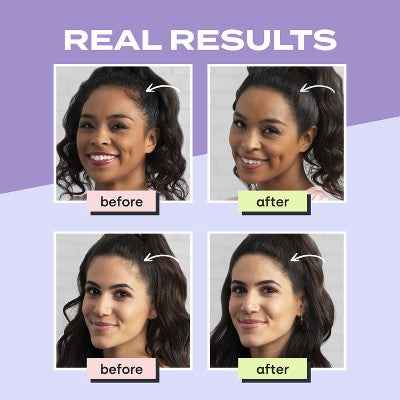 Toppik Hair Filler Volumizing Micro-Fibers - Medium Brown 0.42oz - Imperfect Container