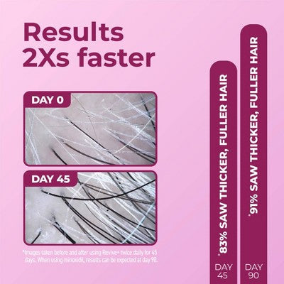 BosleyMD Revive + Densifying Hair Regrowth Serum for Women 1 fl oz - Imperfect Box by This is Beauty US