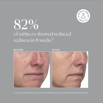 Naturium Azelaic Topical Acid 10% 1 fl oz - Imperfect Box  DestGlow