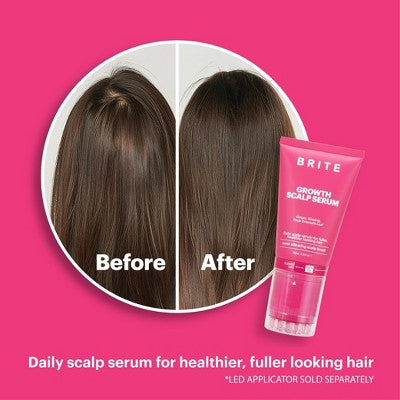 BRITE Refill Growth Scalp Serum 3.38 fl oz - Imperfect Box by This is Beauty US