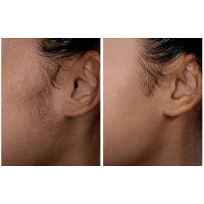 Spa Sciences SIMA Dermaplaning Replacement Safety Tips 6ct - New by This is Beauty US