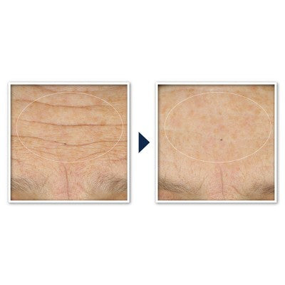 RoC Face &amp; Neck Anti-Aging Moisturizer Firming Cream for Crepey Skin 1.7 fl oz - Imperfect Box
