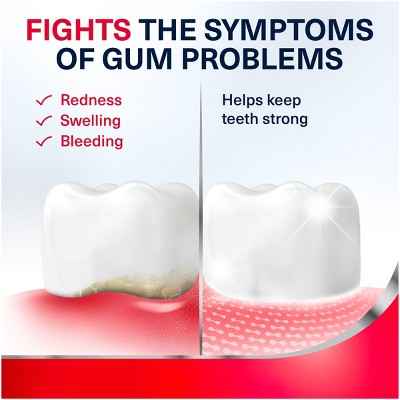 Parodontax Complete Extra Fresh 2pk Toothpaste - Imperfect Box