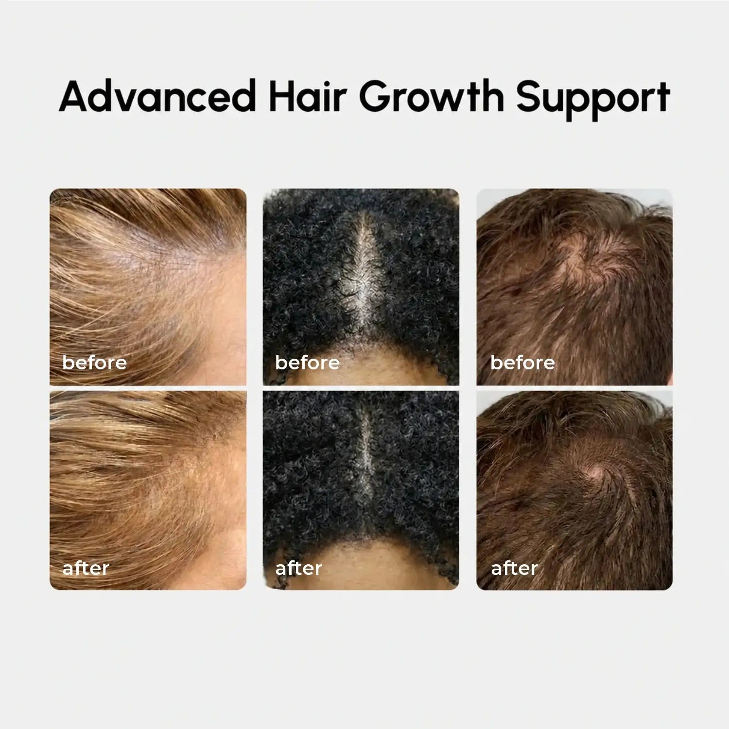 4-in-1 Hair Growth Spray by Maree