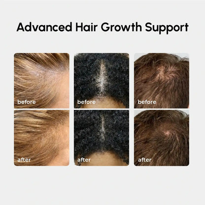 4-in-1 Hair Growth Spray by Maree