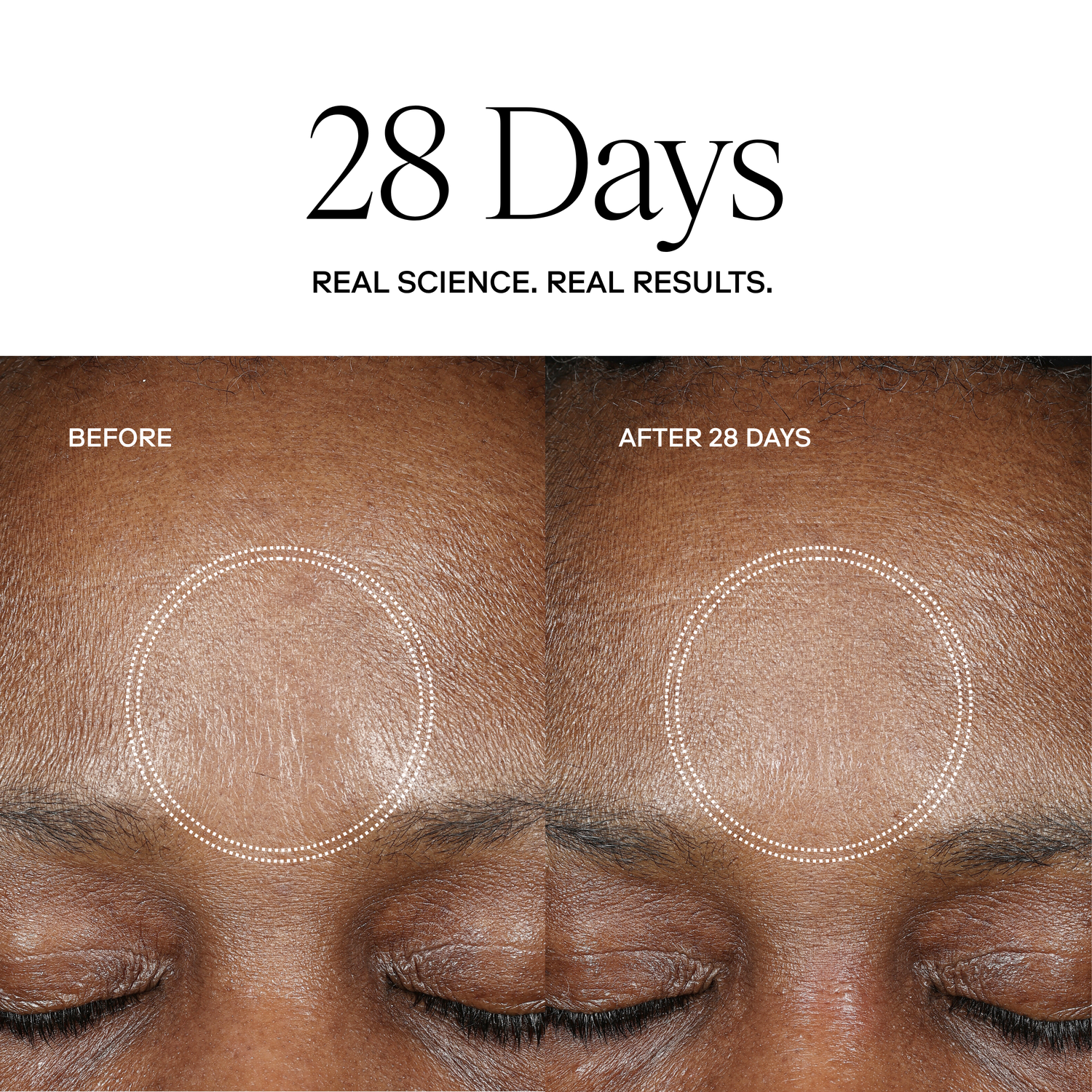 EXO H-SERUM™ Hyaluronic Acid Treatment / eXo³ Exosomes® by Exoceuticals