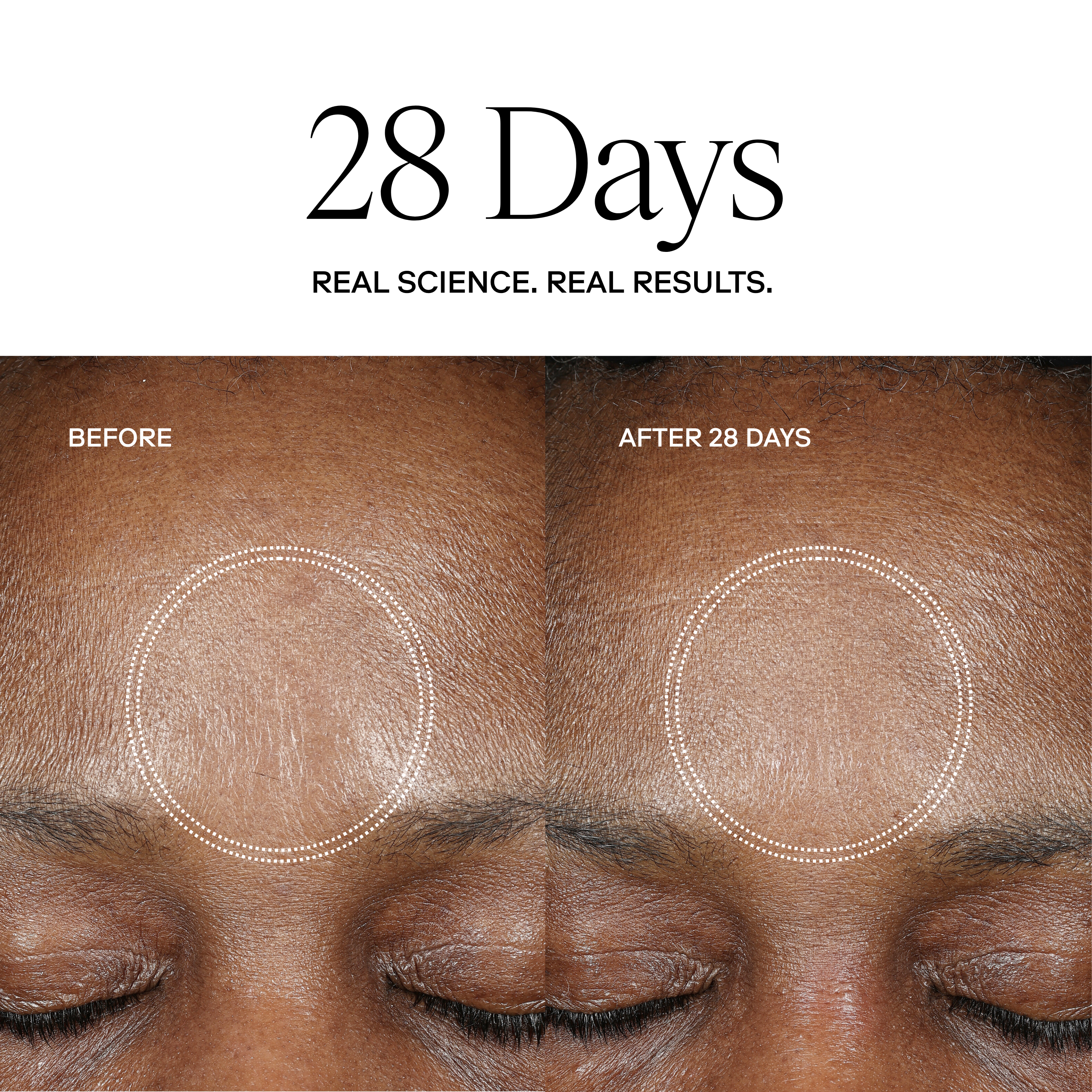 EXO H-SERUM™ Hyaluronic Acid Treatment / eXo³ Exosomes® by Exoceuticals