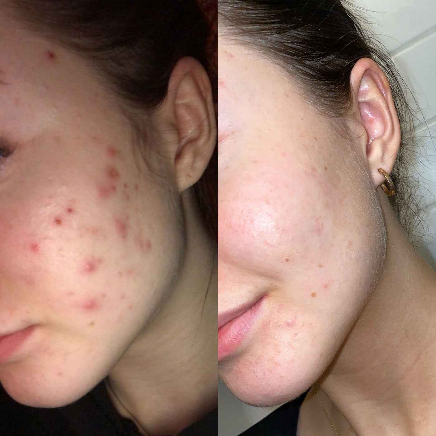 It Girl Skin – Skin Food