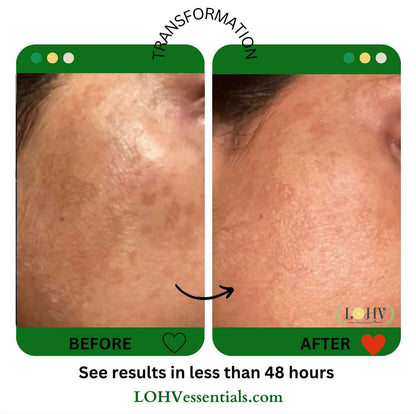 PREMIUM 100% VEGAN GLOW UP Toner Serum With Hyaluronic Acid + Niacinamide + Camellia Leaf + Vitamin E + Rose Water