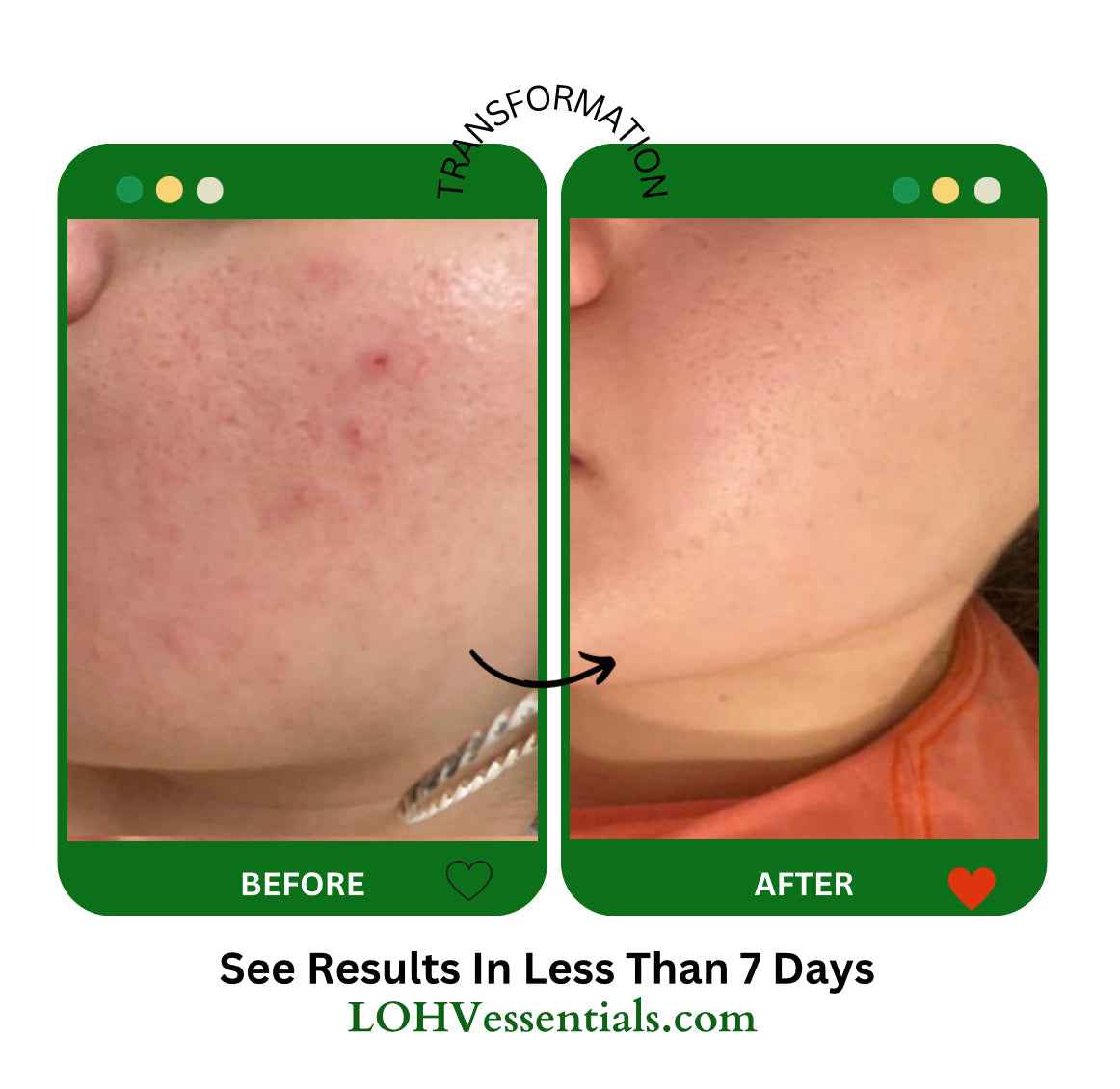 PREMIUM 100% VEGAN Rejuvenating JELLY FACE MASK With Retinol + Turmeric + Aloe Vera + Lactic acid + Rosemary Leaf