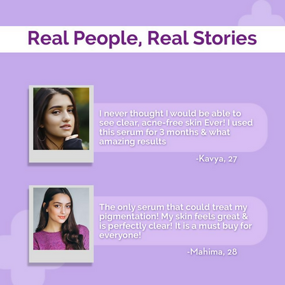 The Derma Co Tran-Zelaic Pigmentation Corrector Serum with Tranexamic Acid &amp; Azelaic Acid