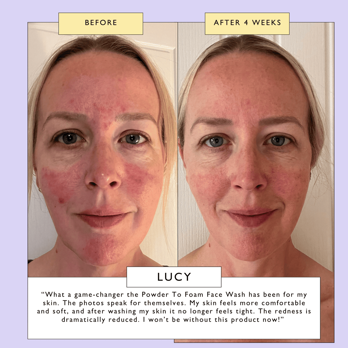 Powder to Foam Face Wash with Willow Bark + Papaya Enzymes  DestGlow