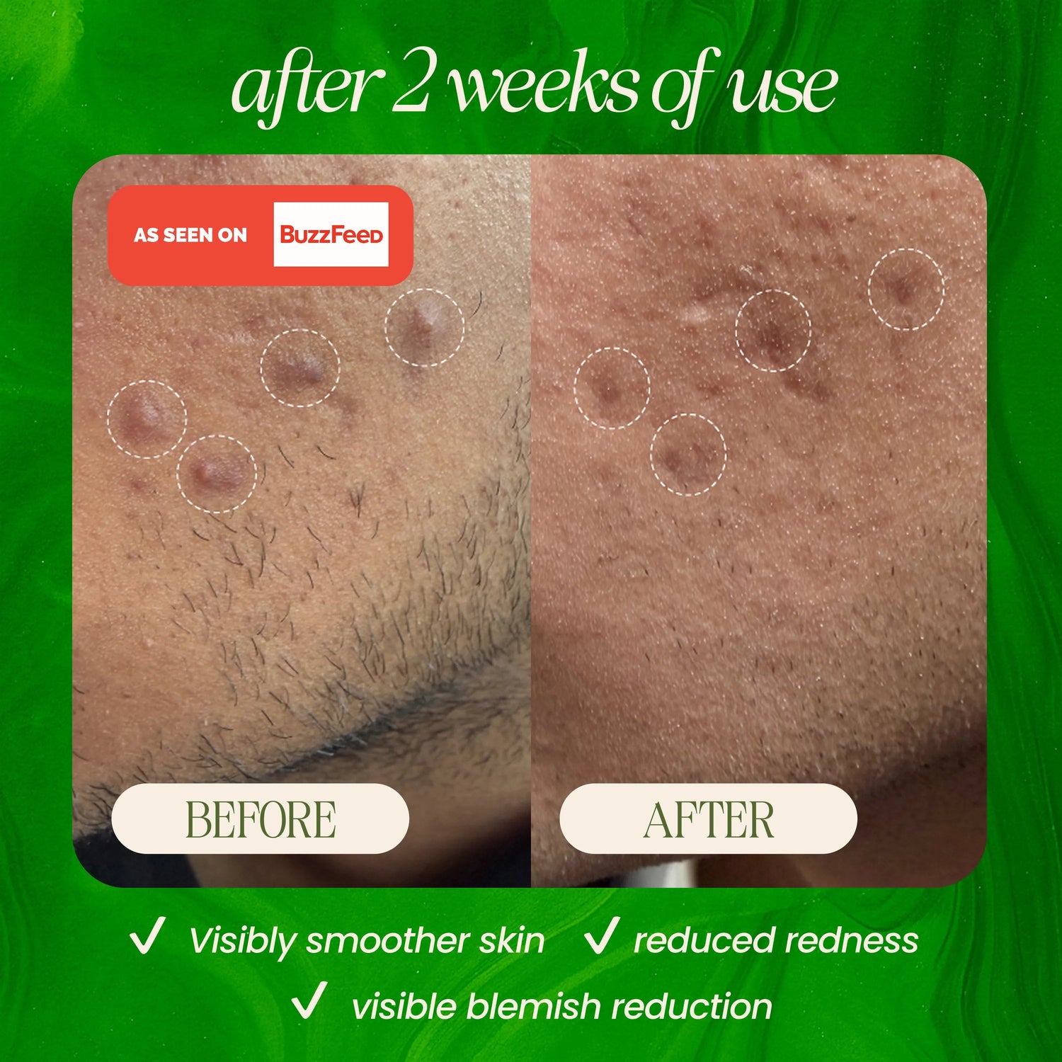 Bamboo Microdermabrasion Exfoliating Cleanser 