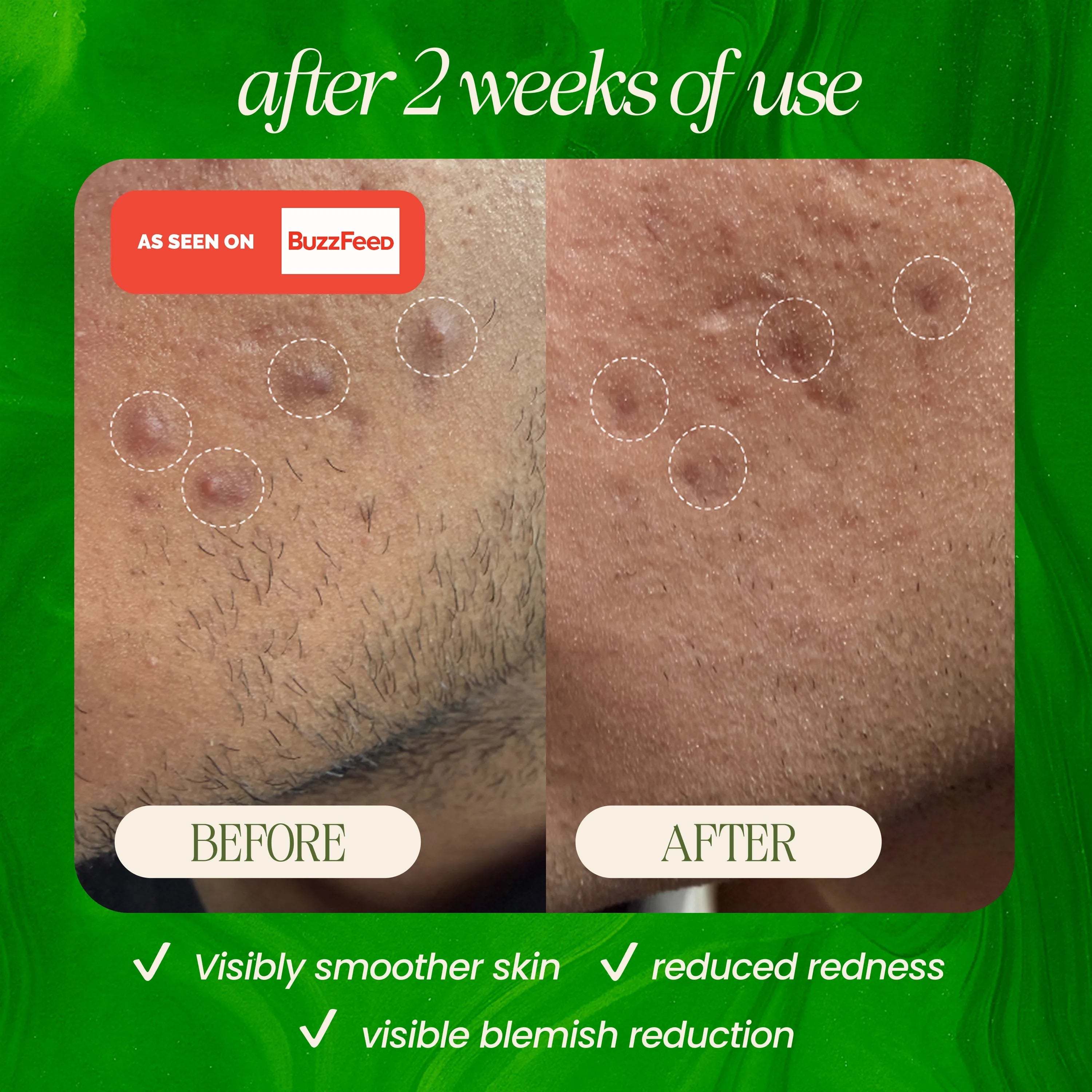 Bamboo Microdermabrasion Exfoliating Cleanser 